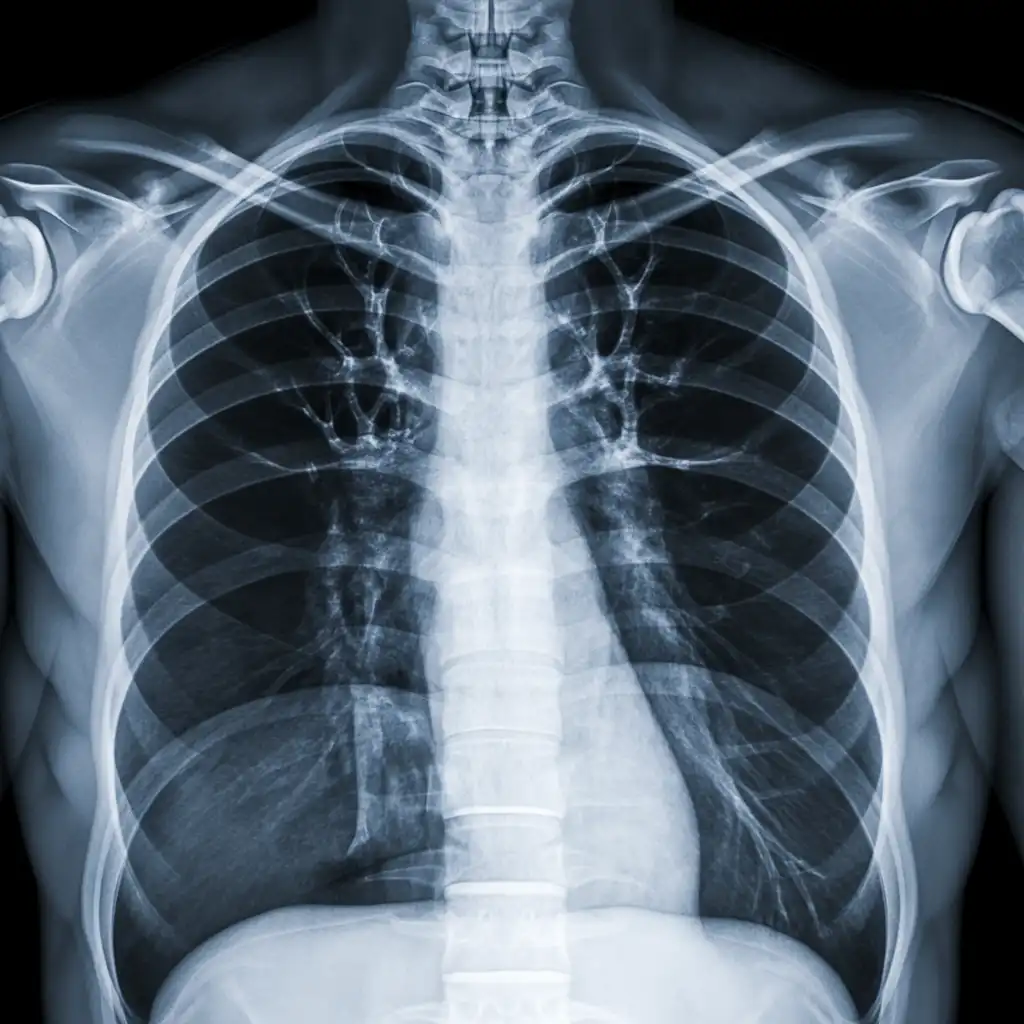 radiografia torace milano